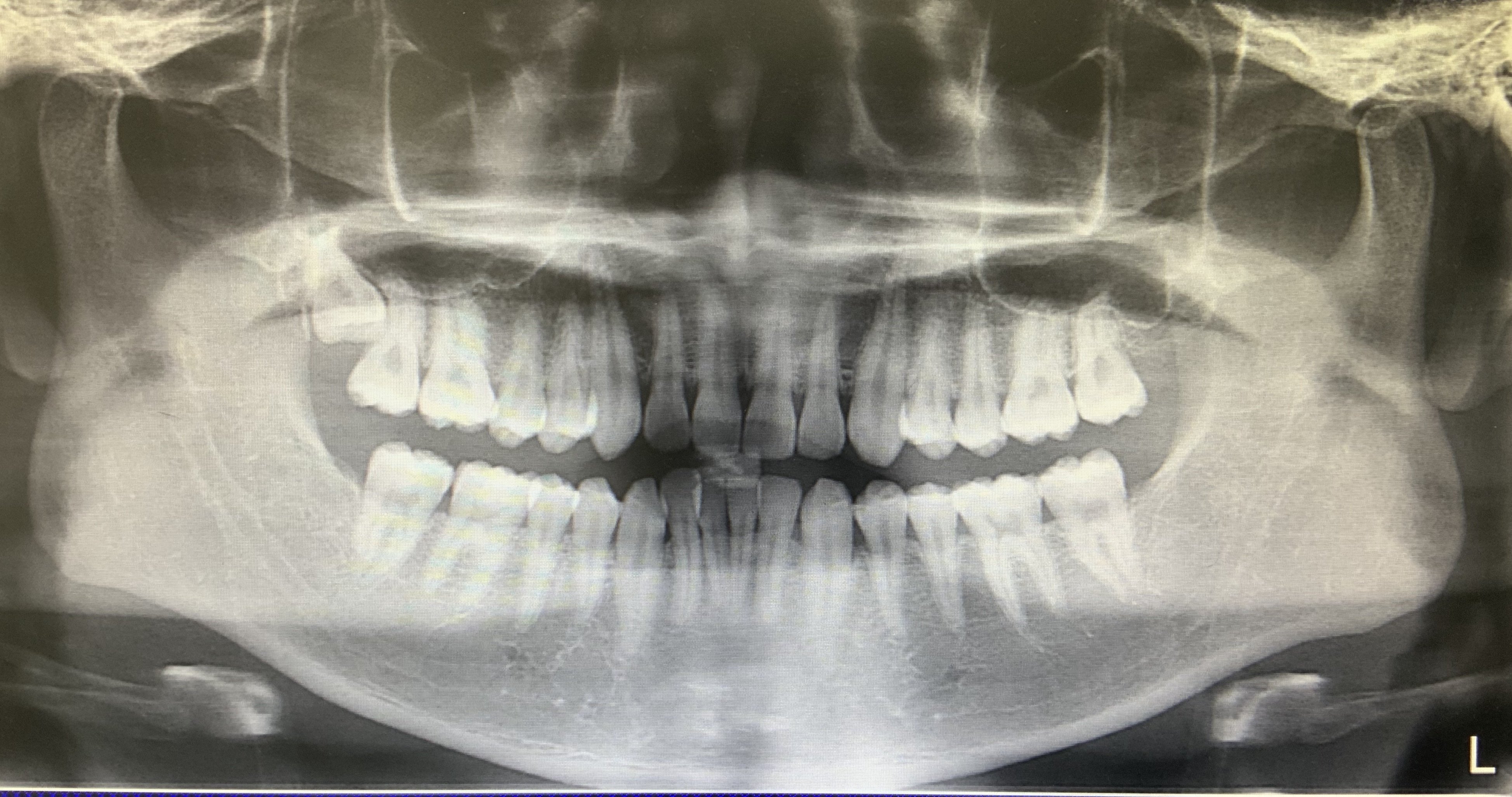 放射線学｜Dentalobo