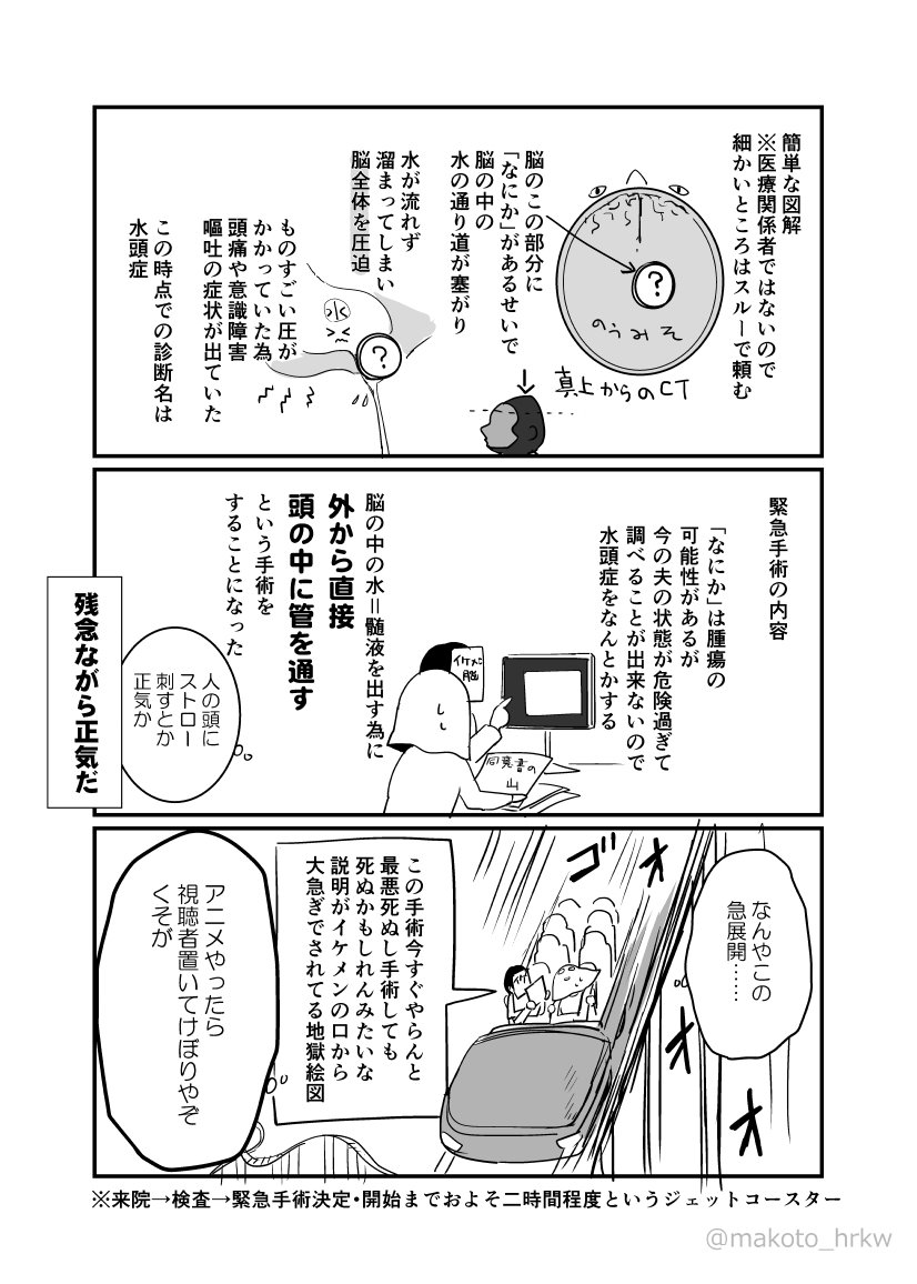 脳腫瘍の話 春川マコト Note 脳腫瘍の話 春川マコト Note