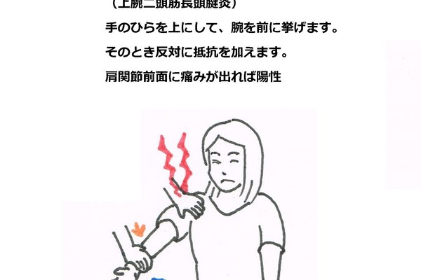 上腕二頭筋長頭腱炎 の新着タグ記事一覧 Note つくる つながる とどける 上腕二頭筋長頭腱炎 の新着タグ記事一覧 Note つくる つながる とどける