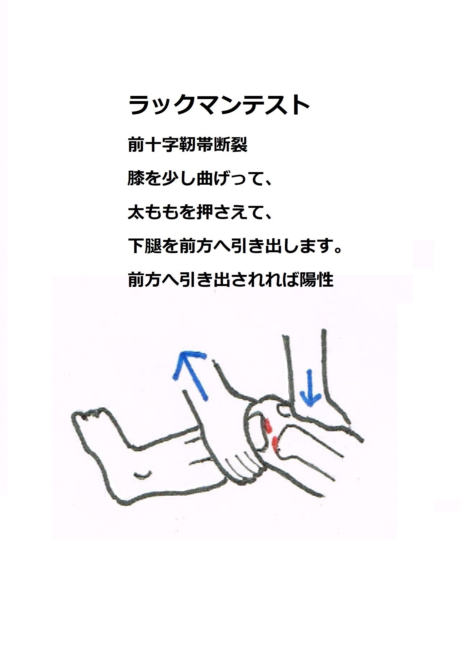 ♯徒手検査法 ♯ラックマンテスト｜ひつじ