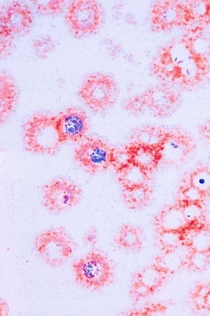 廃物にエロスを感じるのは死へのイメージが共通するからに他ならない が もう一つは生殖器と廃物に形状や色や臭いとしての類似点を想起するからに違いない 山中潤 Note 廃物にエロスを感じるのは死へのイメージが共通するからに他ならない が もう一つは生殖器と廃物に形状や色や臭いとしての類似点を想起するからに違いない 山中潤 Note