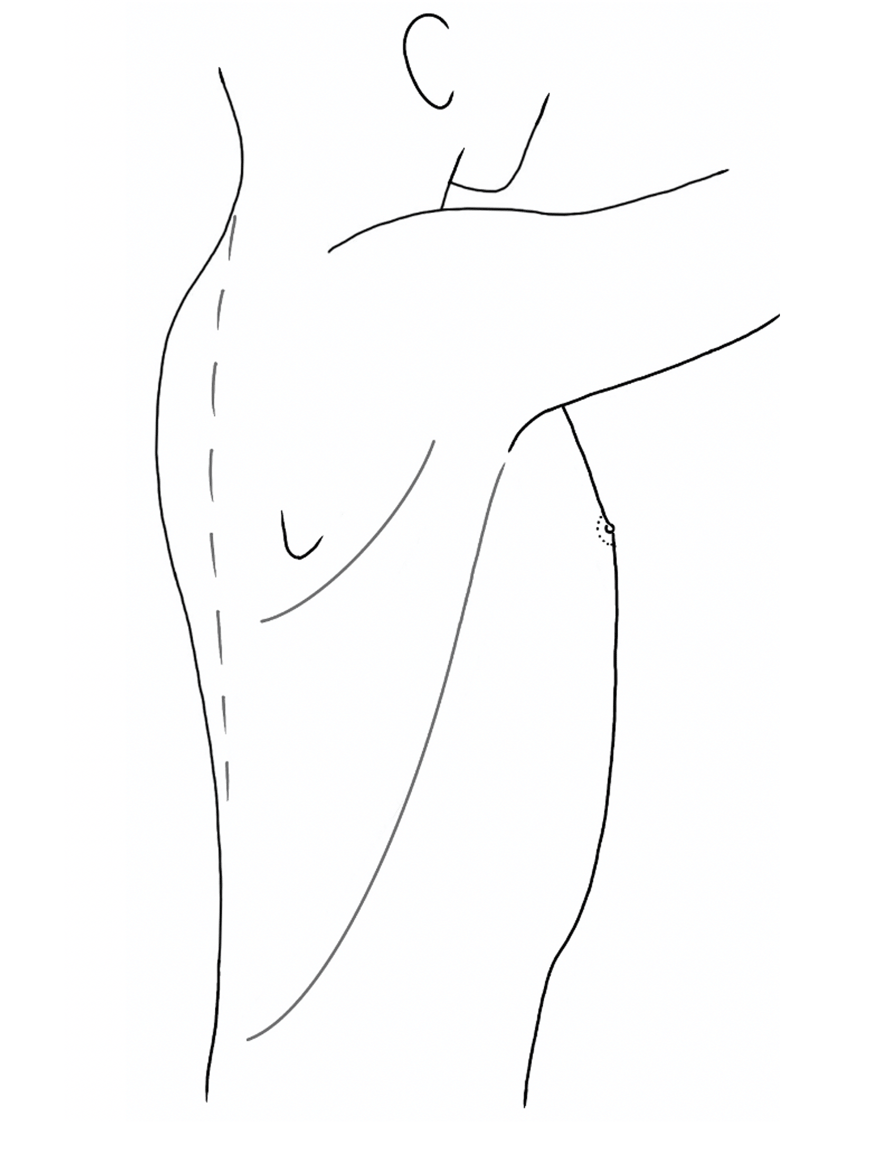 手術記録用イラスト 左側臥位 男性 Bmi 白黒 イラレ勉強中 Note