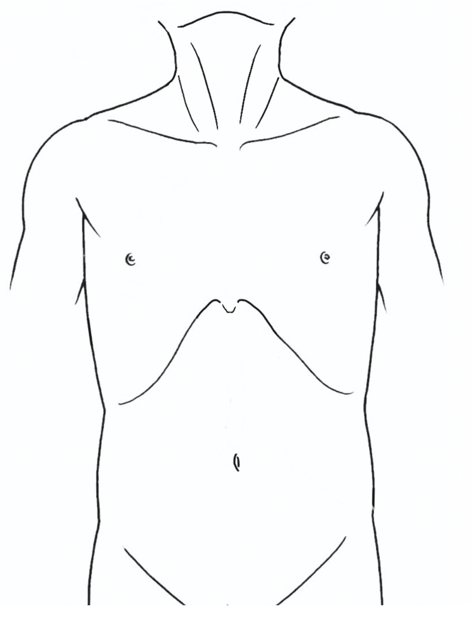 手術記録用オリジナルイラスト 仰臥位 男性 白黒 21年目外科医の妻 Note