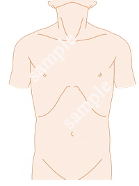 手術記録用オリジナルイラスト 左側臥位 男性 白黒 広背筋 21年目外科医の妻 Note