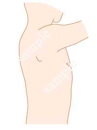 手術記録用オリジナルイラスト 左側臥位 男性 肌色 21年目外科医の妻 Note
