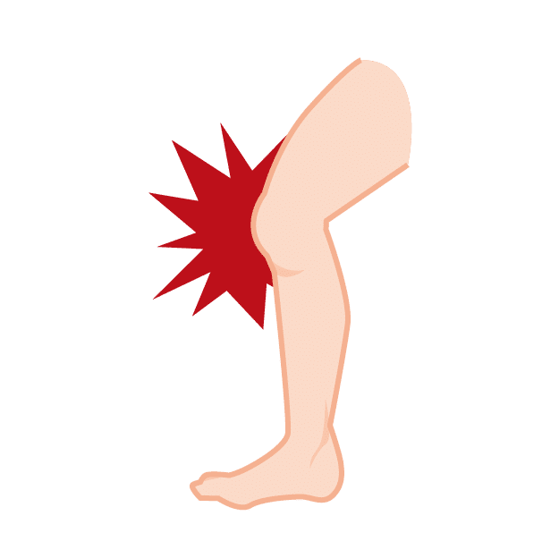 膝の内側の痛み Minna Harikyu Note