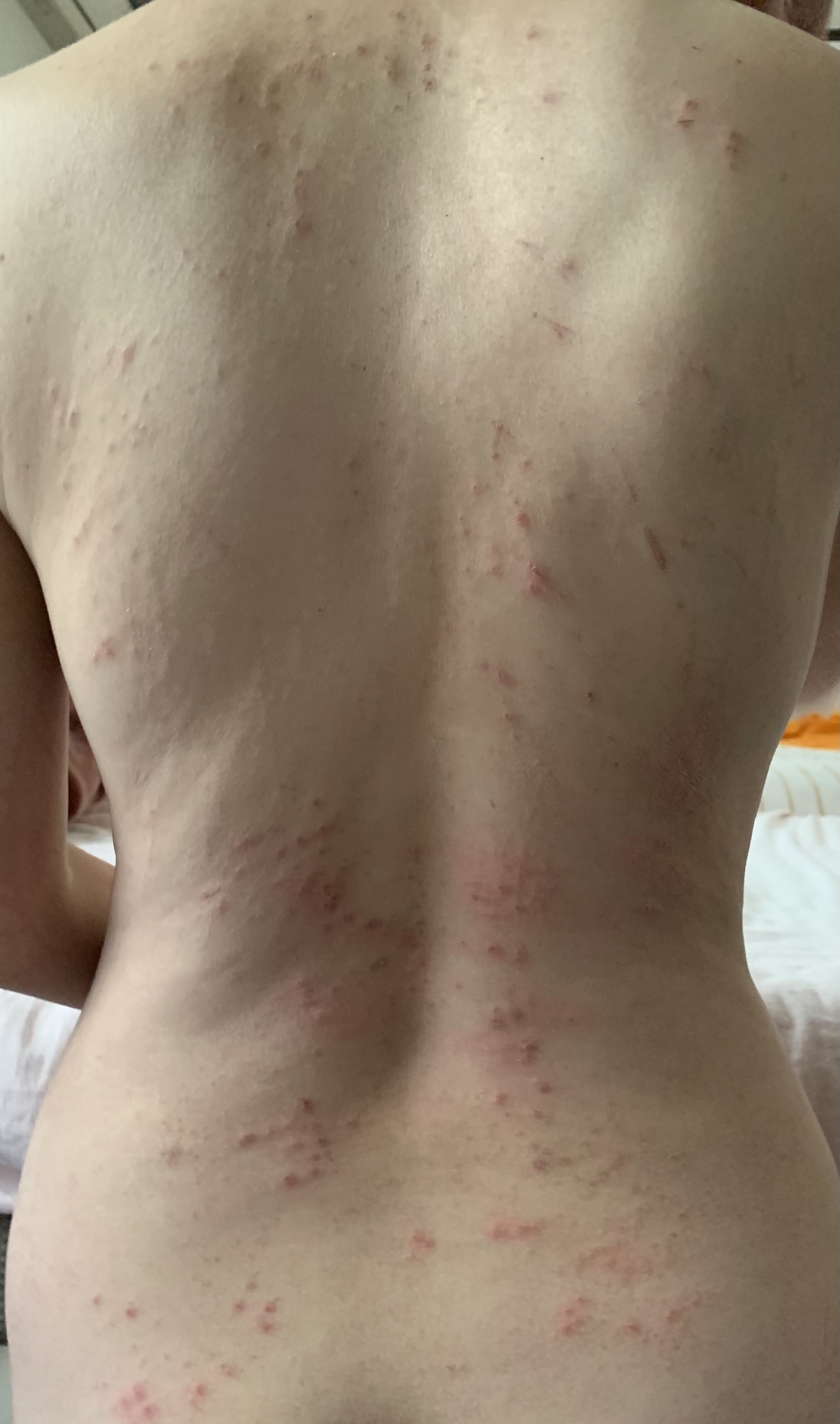 スマートイオン施術記録11日目 村田実奈子 Note