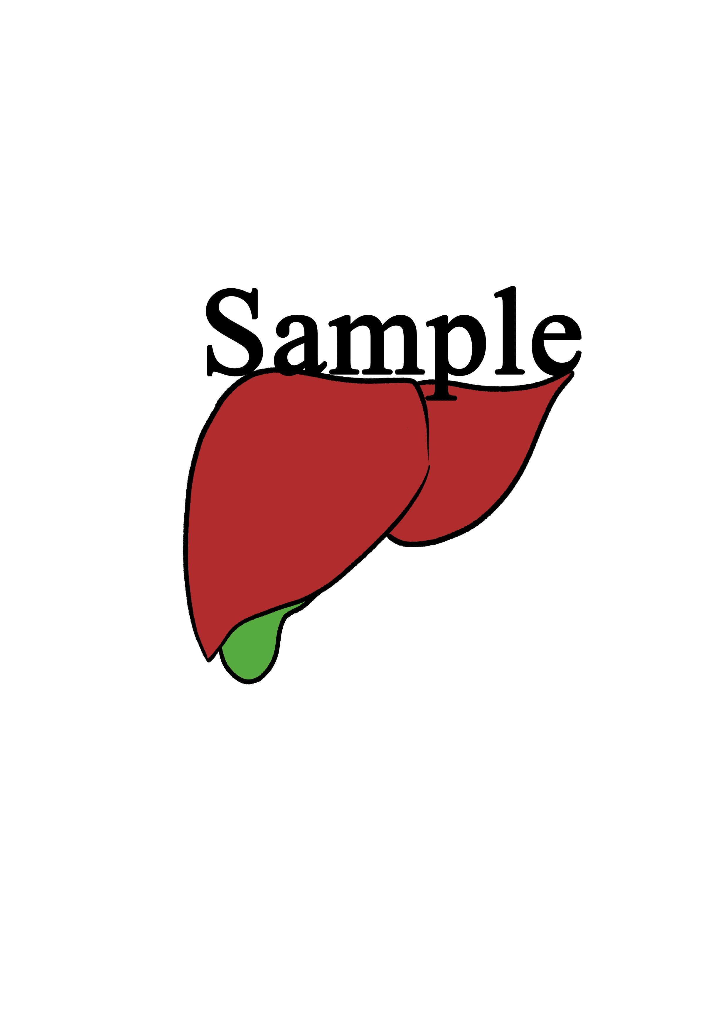 手術記録用オリジナルイラスト肝臓胆嚢pngファイル背景なし 21年目外科医の妻 Note