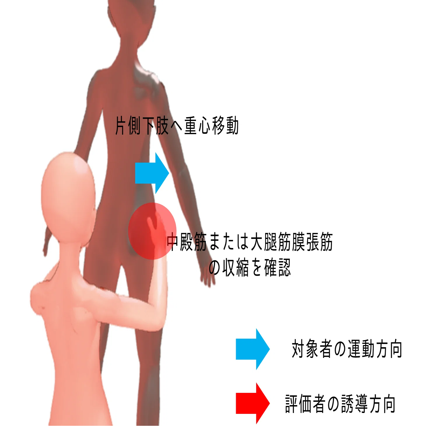 トレンデレンブルグ徴候を深ぼるー原因追求のための評価と歩行分析ー 