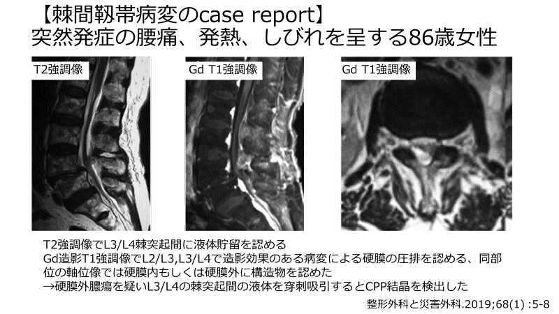 靈智醫學と治病 疱疹导致老年痴呆——证据越来越充足- BBC 英伦网