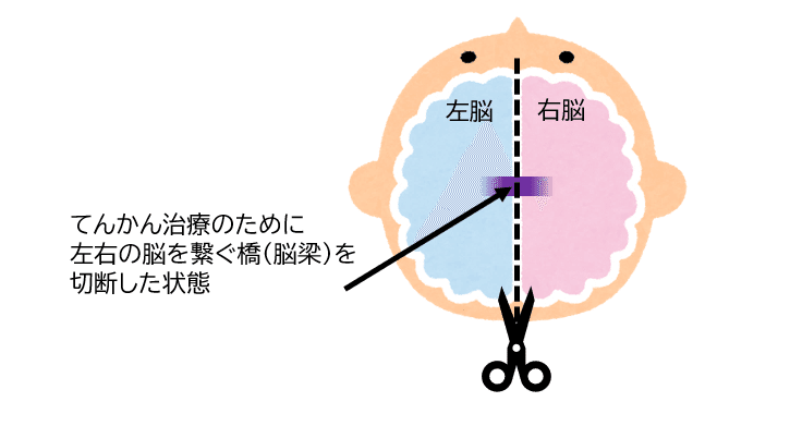 分離脳実験と「自分らしく!」|ニワトロイド|note