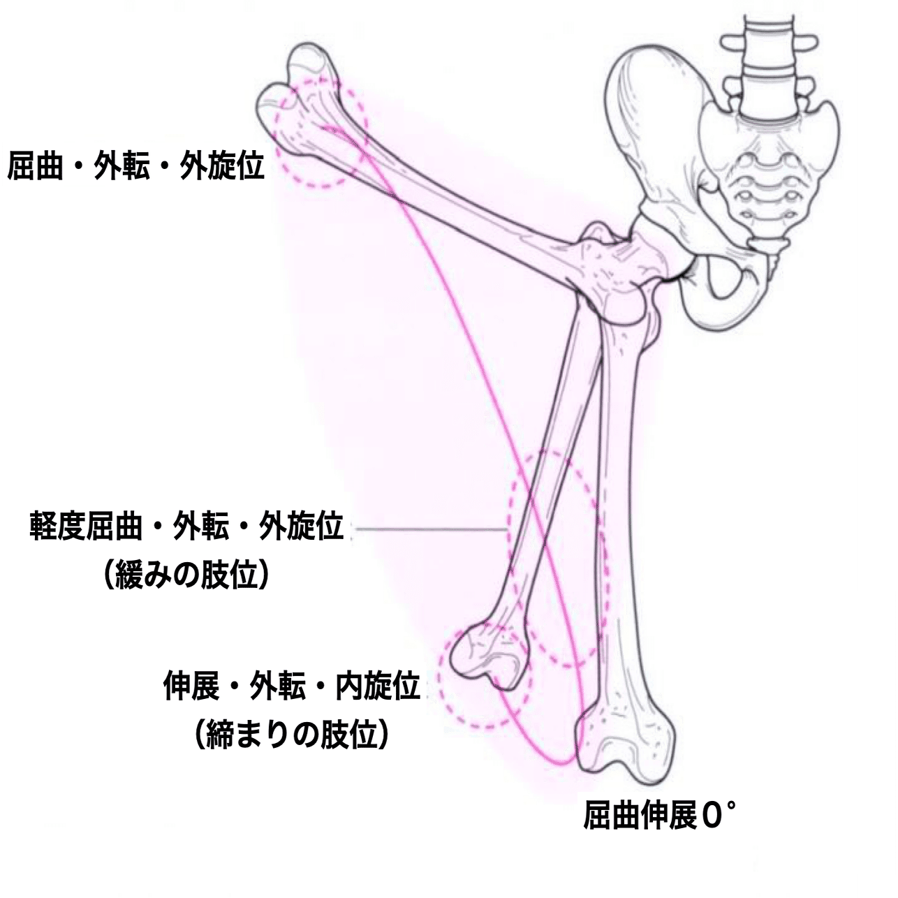 股関節痛の理学療法②〜股関節不安定性に対する評価とアプローチ
