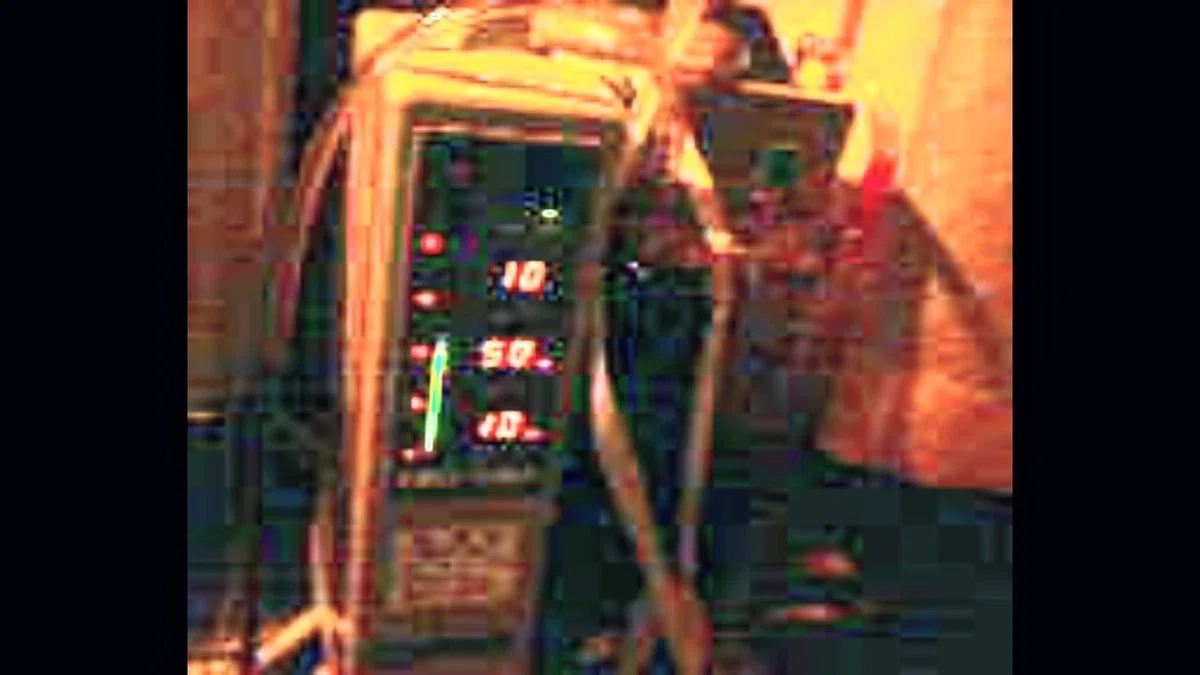 腸閉塞③｜イレウス
