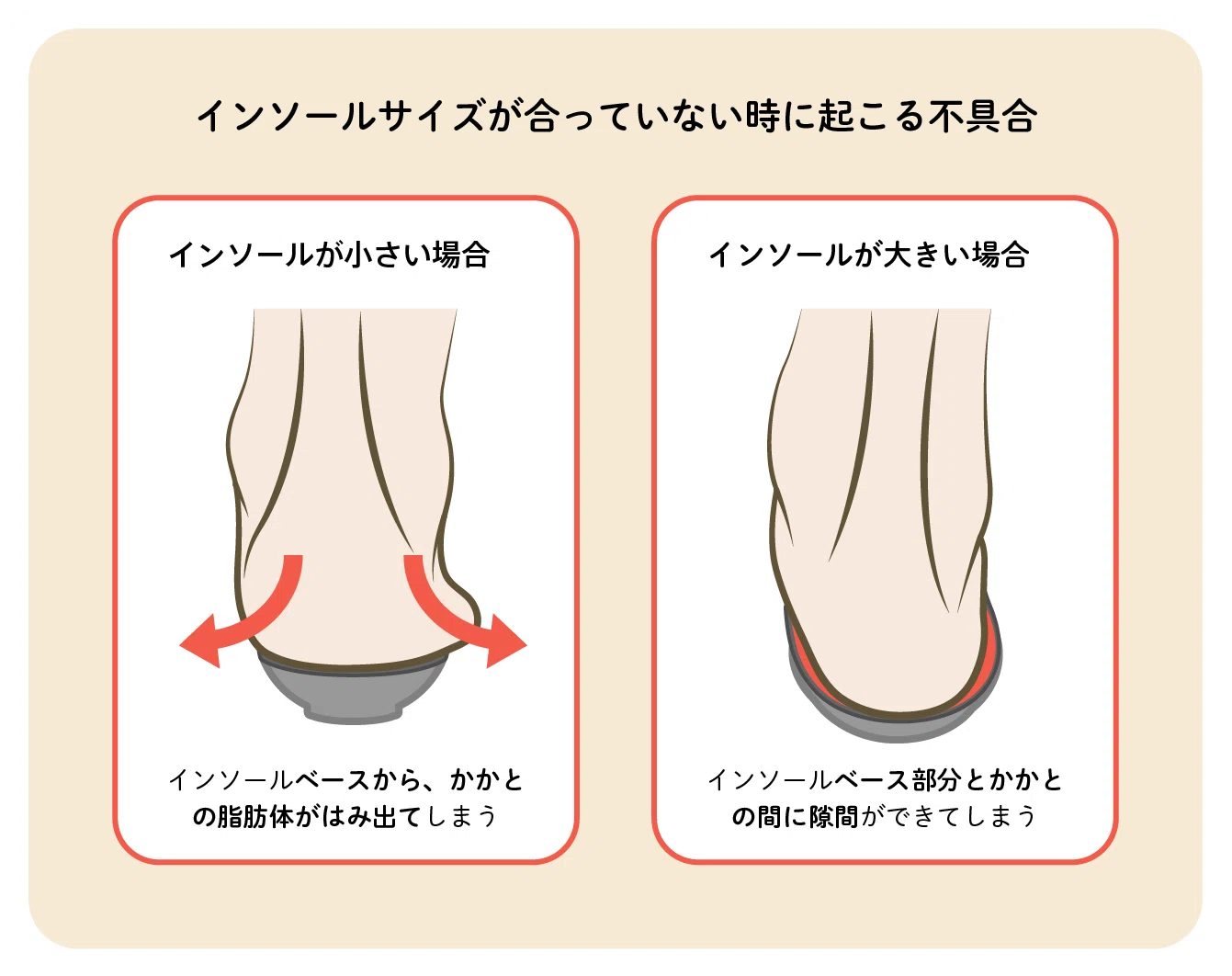 間違いはトラブルの元。HOCOHインソールの正しいフィッティングと 