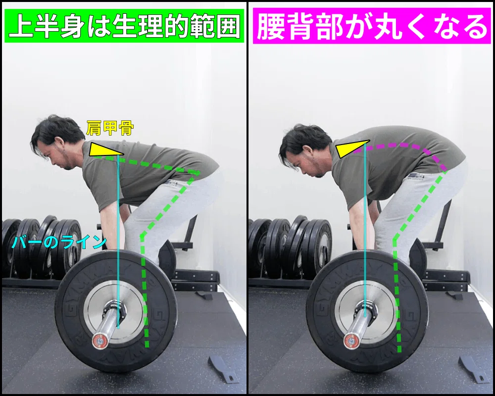 デッド リフト 腰痛 い