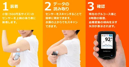 ずぼらでも血糖値　センサー フリースタイルリブレで血糖値を測定してみた｜井上 周/ INOUE Amane