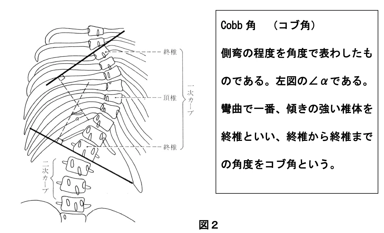 国際カイロプラクティック試験委員会(IBCE)の試験をパスするために