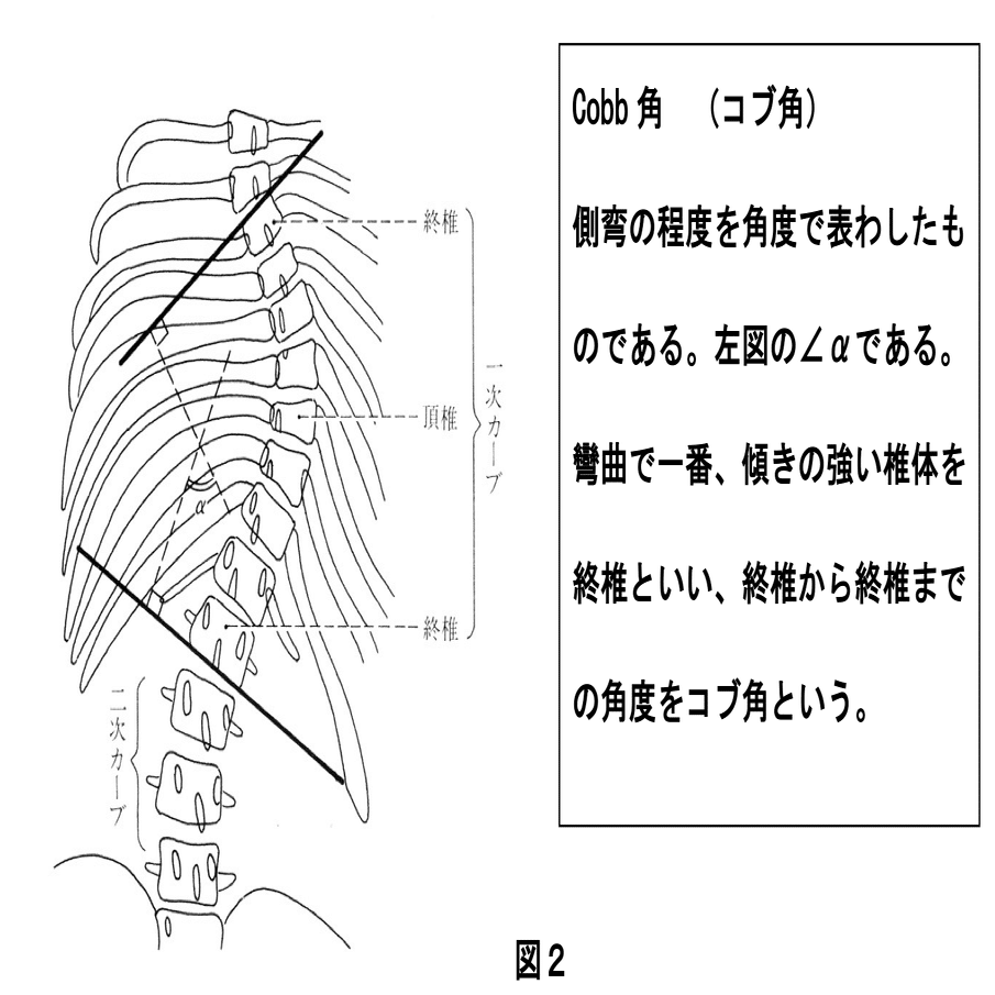 国際カイロプラクティック試験委員会(IBCE)の試験をパスするために