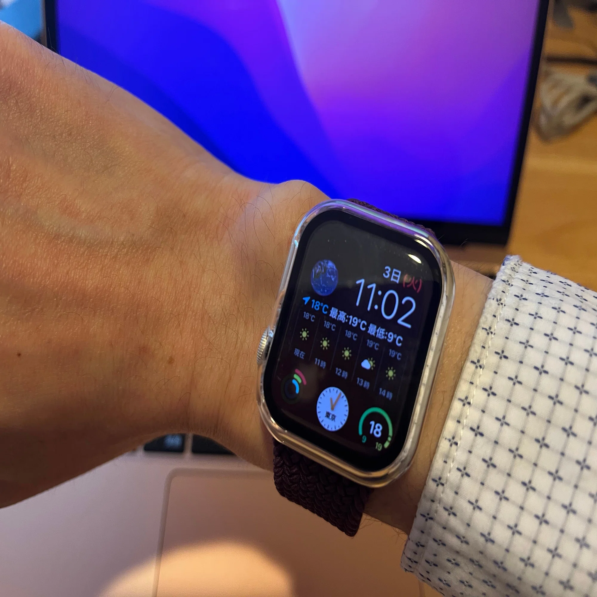 買ったばかりのApple Watchが破損してしまいました｜まさ@アラフィフ