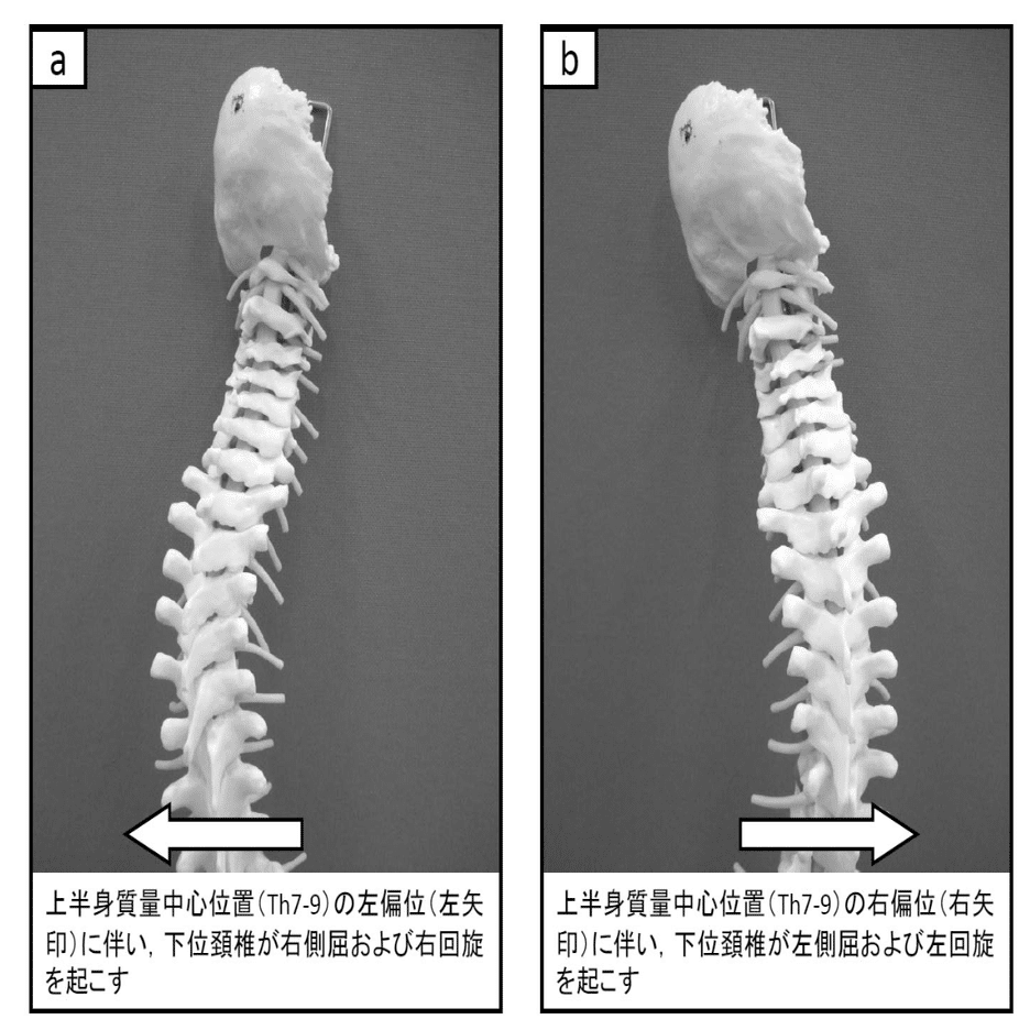 頸部痛の理学療法〜苦手意識を克服したいセラピストへ〜｜理学療法士