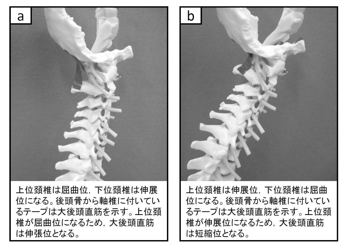頸部痛の理学療法〜苦手意識を克服したいセラピストへ〜|理学 頸部痛の理学療法〜苦手意識を克服したいセラピストへ〜|理学