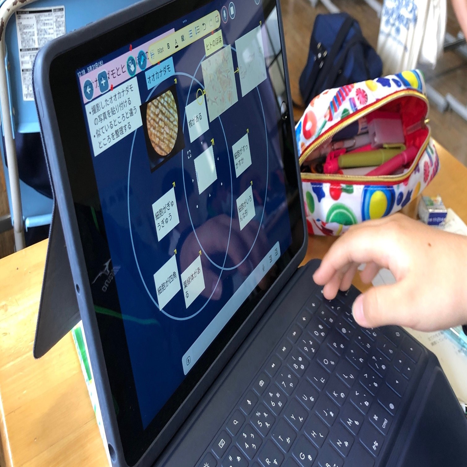 かずひろ先生の【徹底的国試対策】解剖学 - 【移行上皮の特徴】 移行上皮とは、尿を貯留する泌尿器系に特有の上皮です。  ・腎杯・腎盂・尿管・膀胱（4点セットで覚える → チャンク化） ⸻ 🌟【なぜ移行上皮が必要なの？（理由付け）】 移行上皮は、尿の貯留・排出に ..., image size:2000x1128