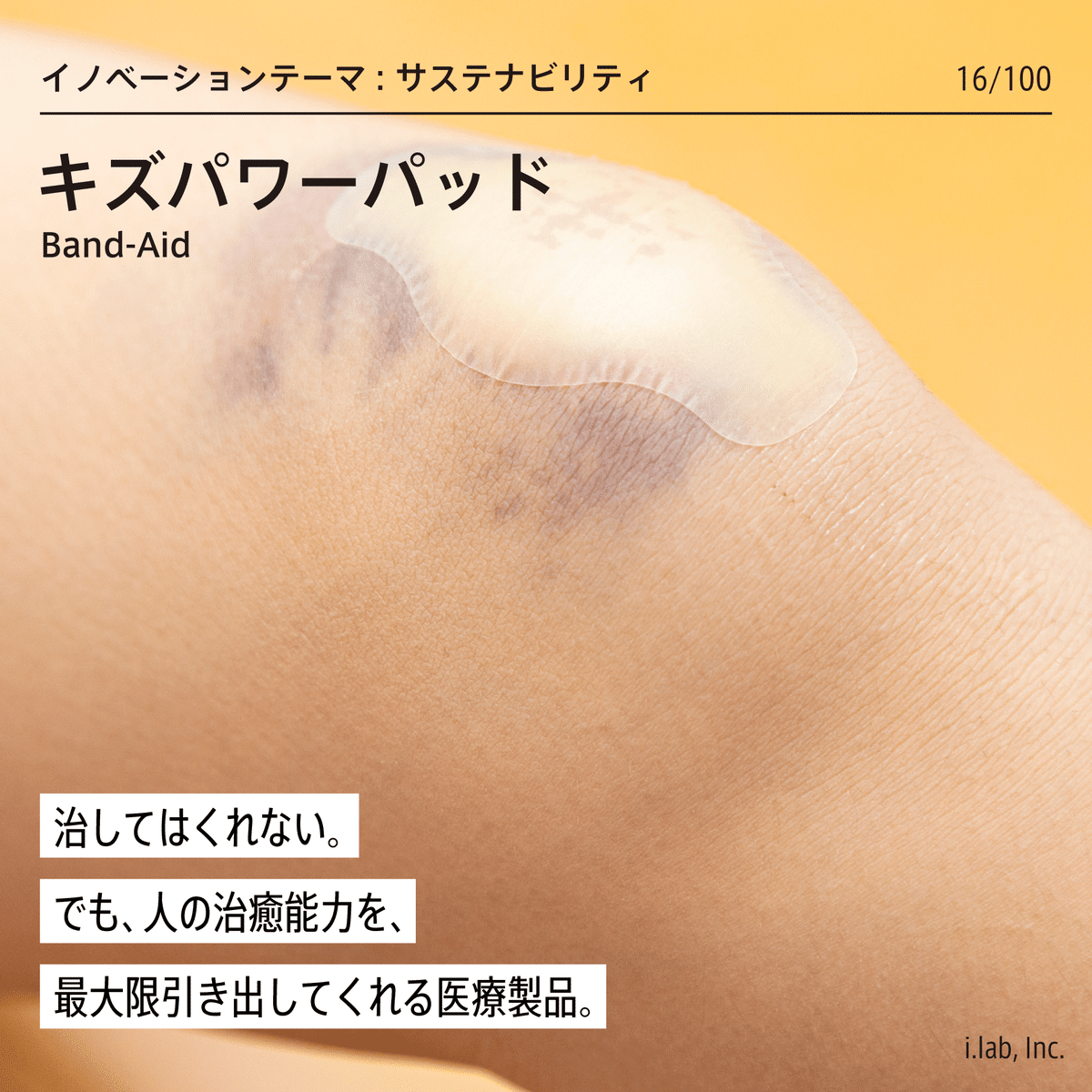 キズパワーパッド：治してくれるわけではない。でも、自己治癒力