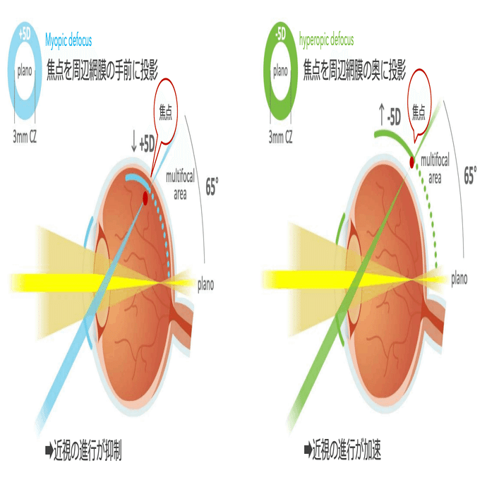 クボタメガネテクノロジーとは 窪田製薬hd Note