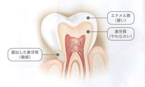歯の構造の画像
