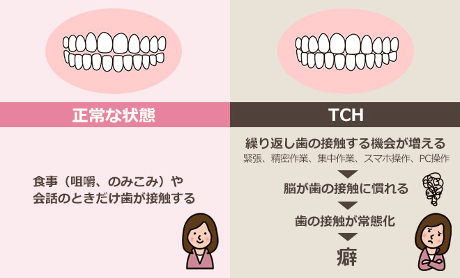 TCHの解説イラスト