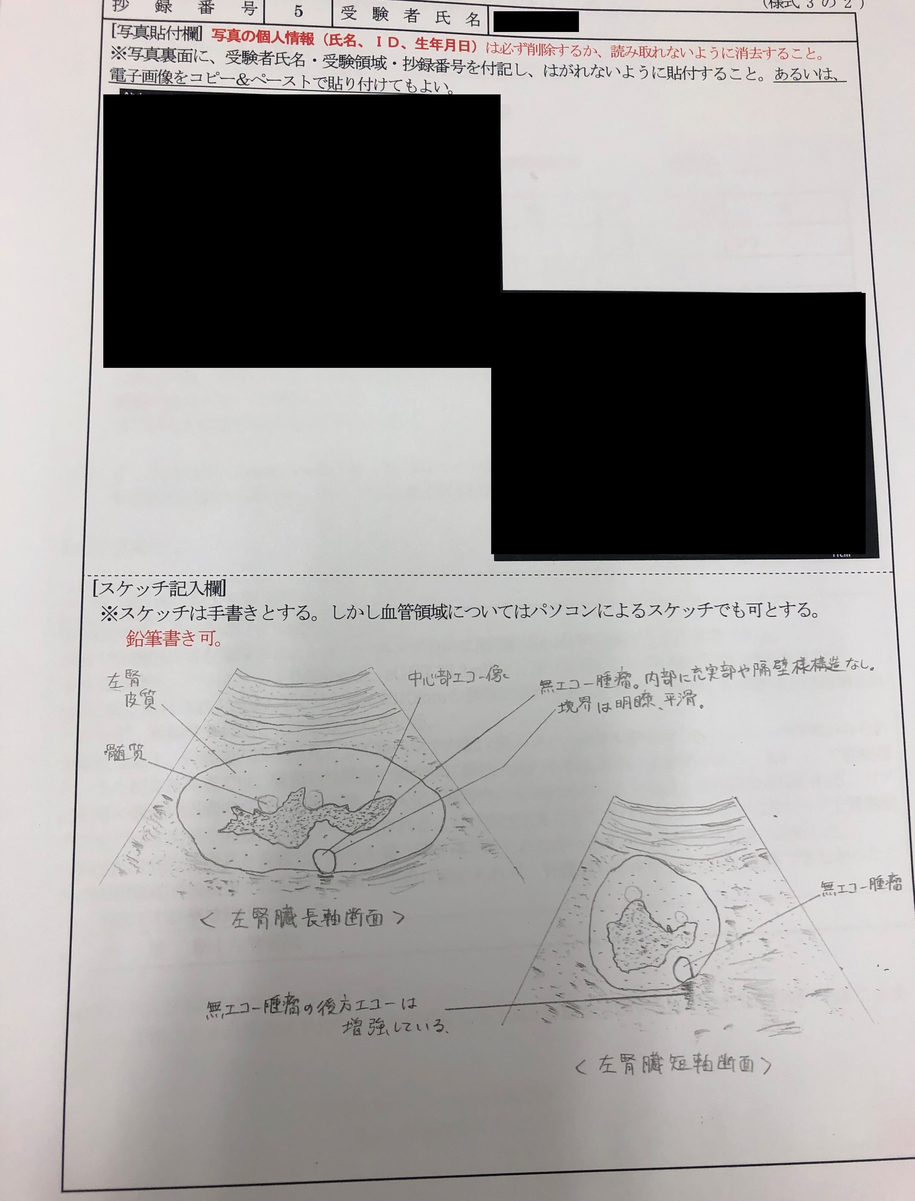 超音波検査士レポート（泌尿器その⑤腎嚢胞）｜ふるかぶ