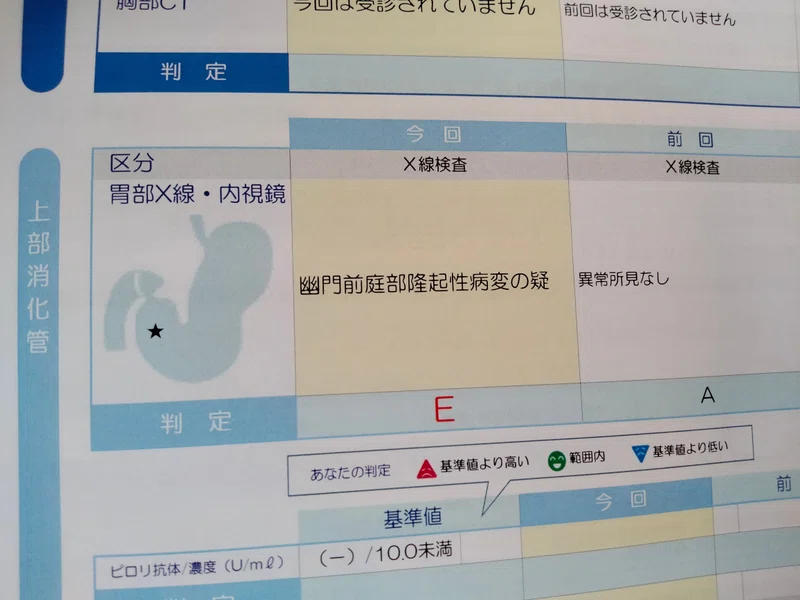 幽門前庭部隆起性病変(疑)|*Ⅲơ₃ơⅢ*栗英田テツヲ|note