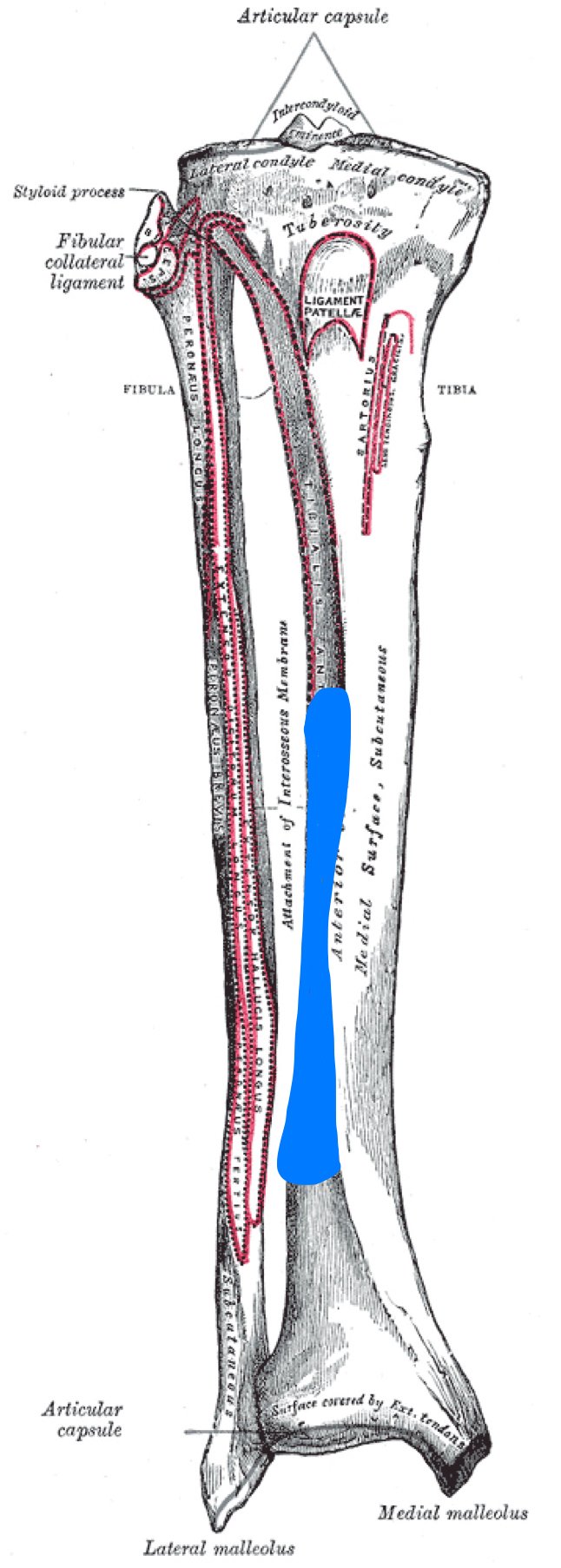 Medial Tibial Stress Syndrome(シンスプリント)に関して①