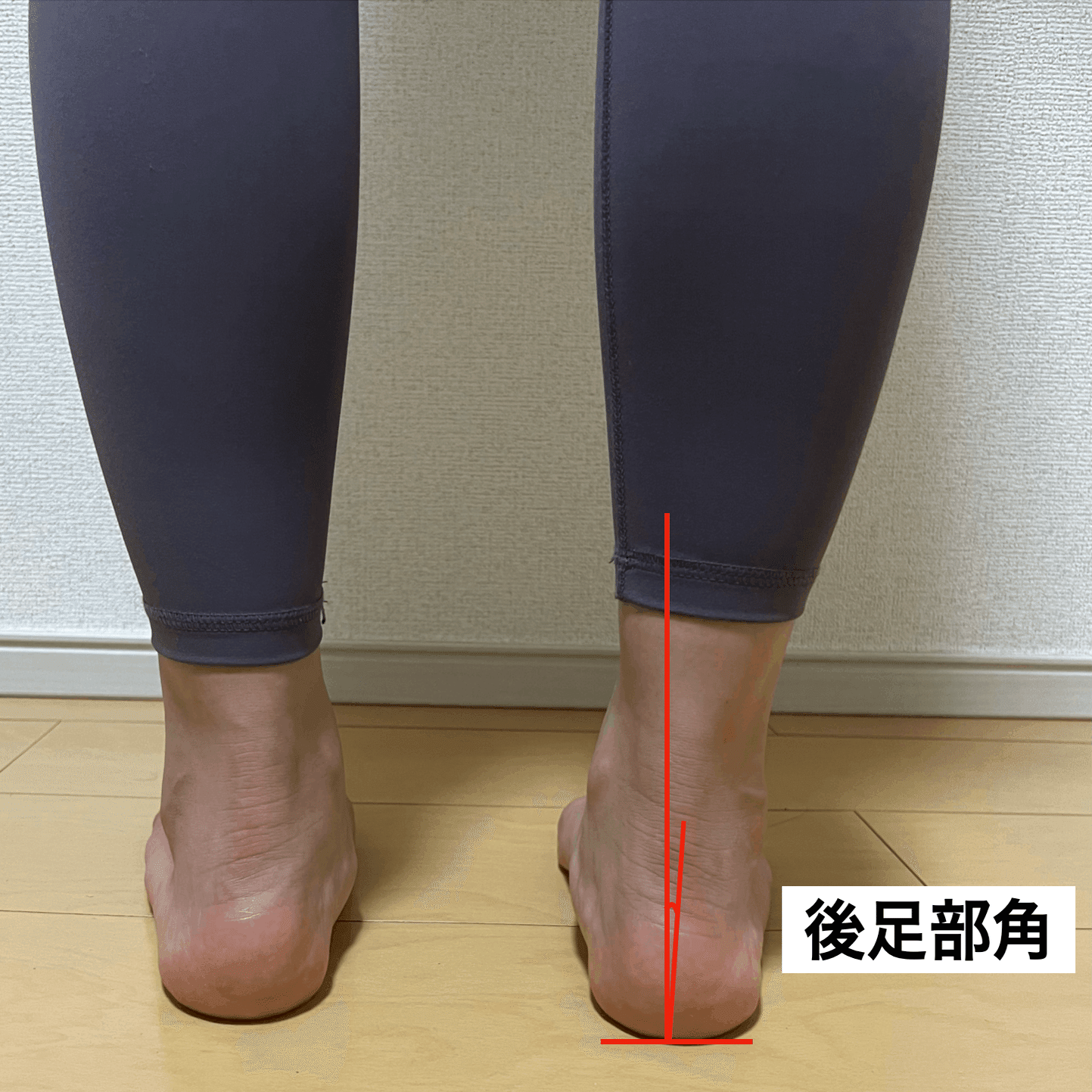 足関節痛の理学療法〜足部が苦手でもできる評価とアプローチ〜｜理学