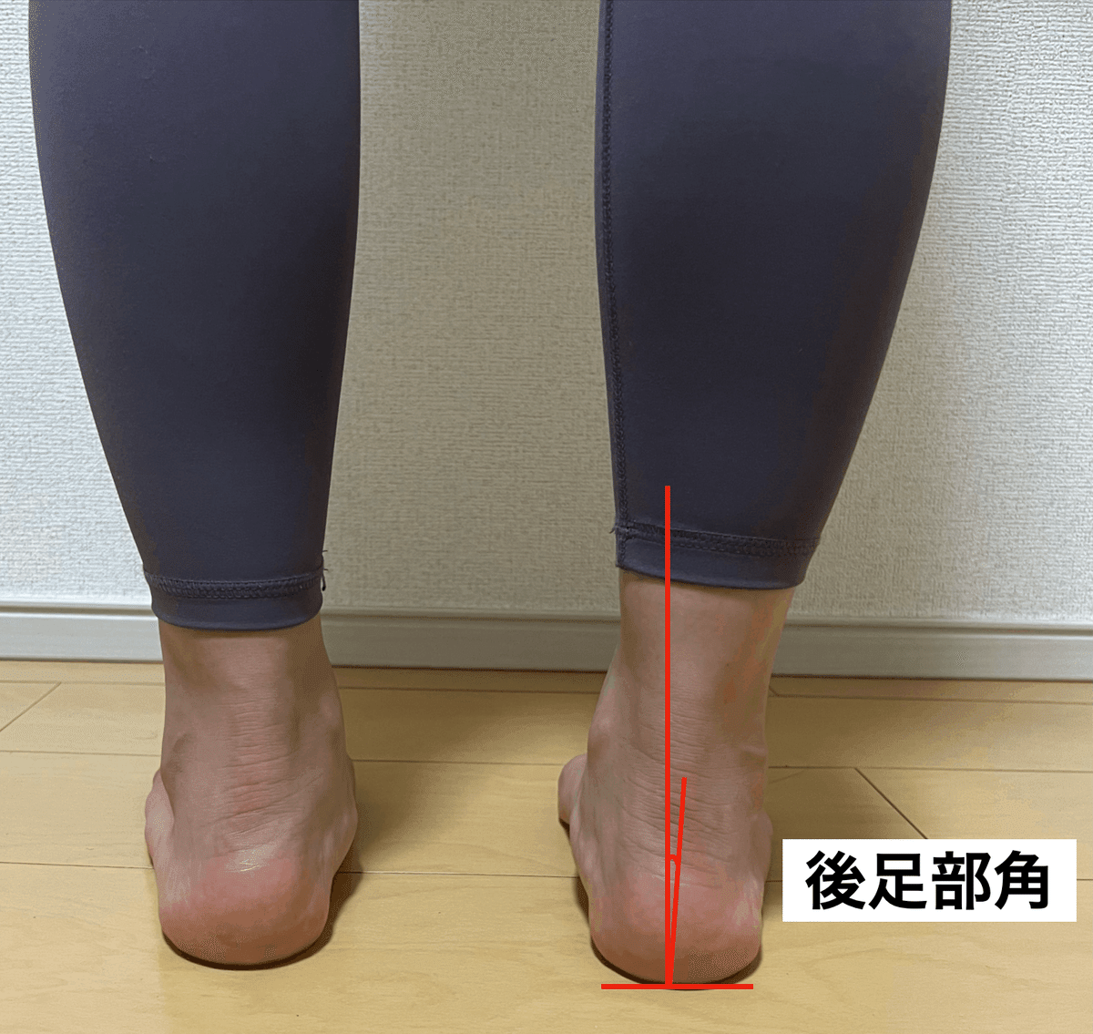 メジカルビュー社 | 理学療法マネジメント