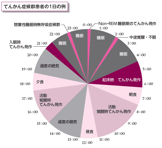 ちょい見せ】24時間医学で考えるてんかん症候群｜中外医学社Online