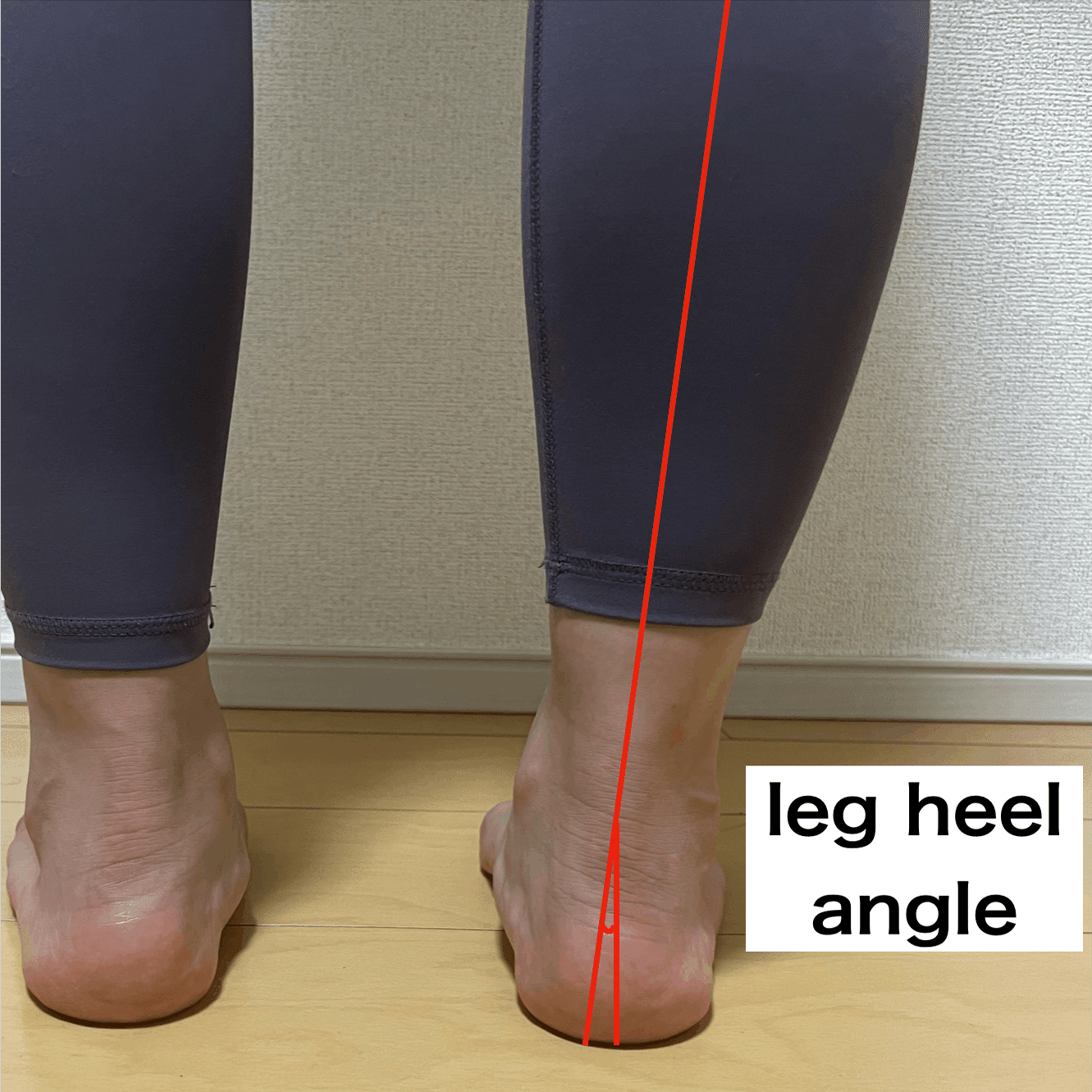 足関節痛の理学療法〜足部が苦手でもできる評価とアプローチ