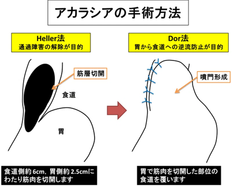 消化器病専門医試験 対策画像＋表【2025年10月】｜内視鏡専門医試験