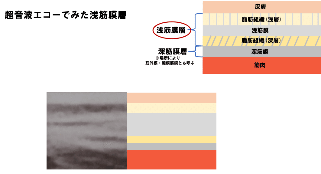 「頸部の緩和」浅筋膜シリンダーと運動シリンダーへのアプローチ トム ・ マイヤーズ ANATOMY TRAINSEasing the Neck with Tom Myers