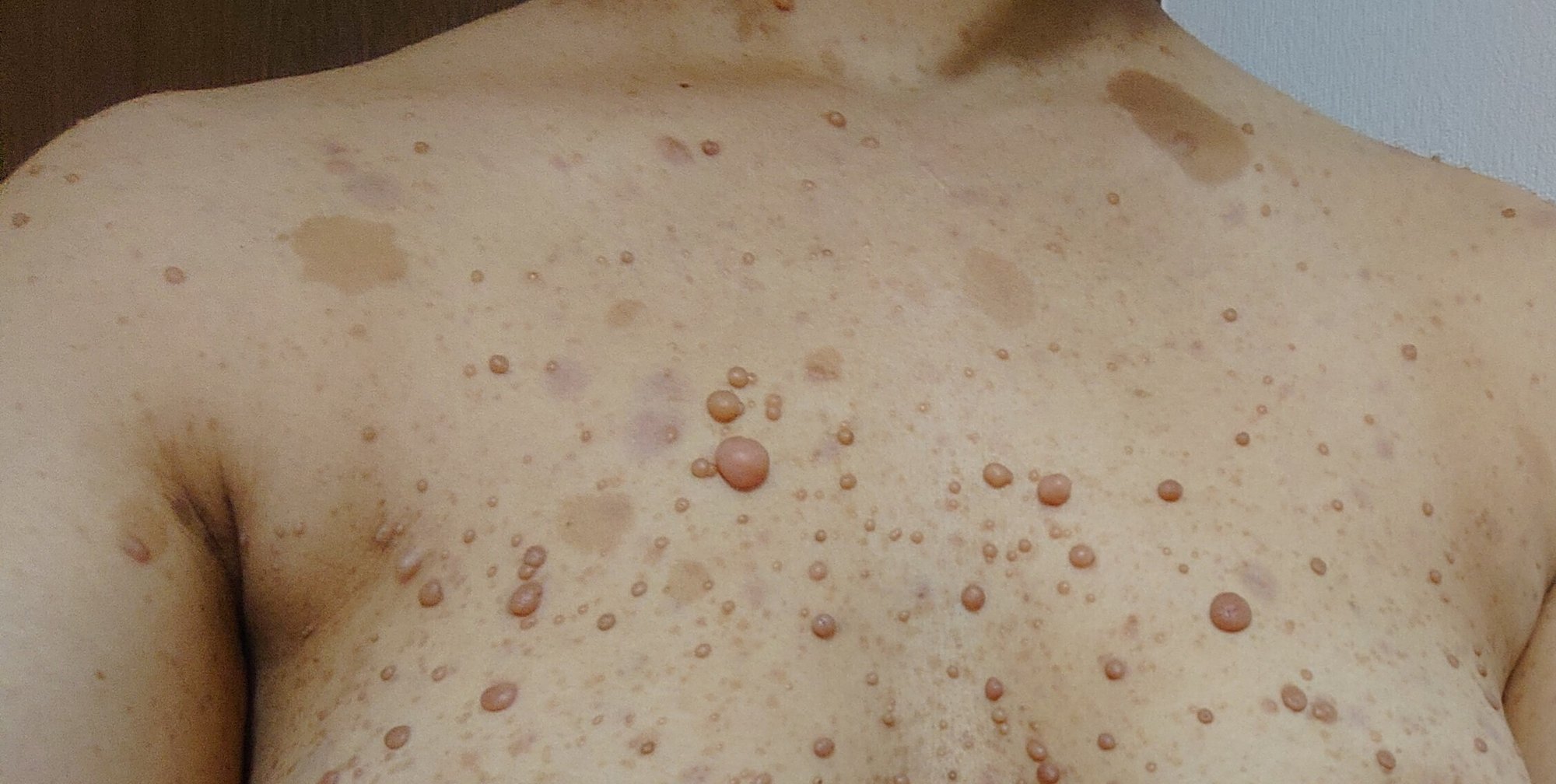 理解して欲しいなら自分がまず認めてあげる 大河内愛美 指定難病と向き合うガラス作家 Note 理解して欲しいなら自分がまず認めてあげる 大河内愛美 指定難病と向き合うガラス作家 Note