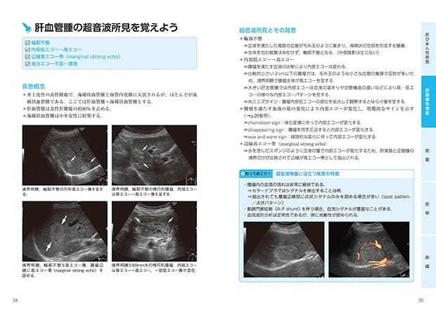 新構成の「超音波検査士認定試験対策:臨床編」第1弾が出版され 新構成の「超音波検査士認定試験対策:臨床編」第1弾が出版され