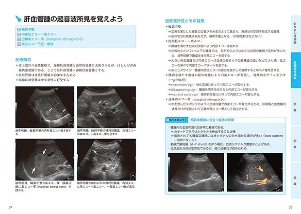 新構成の「超音波検査士認定試験対策：臨床編」第１弾が出版されます ...