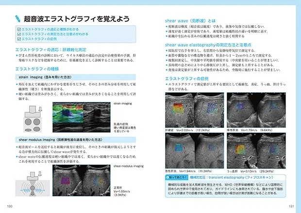 新構成の「超音波検査士認定試験対策：臨床編」第1弾が出版されます
