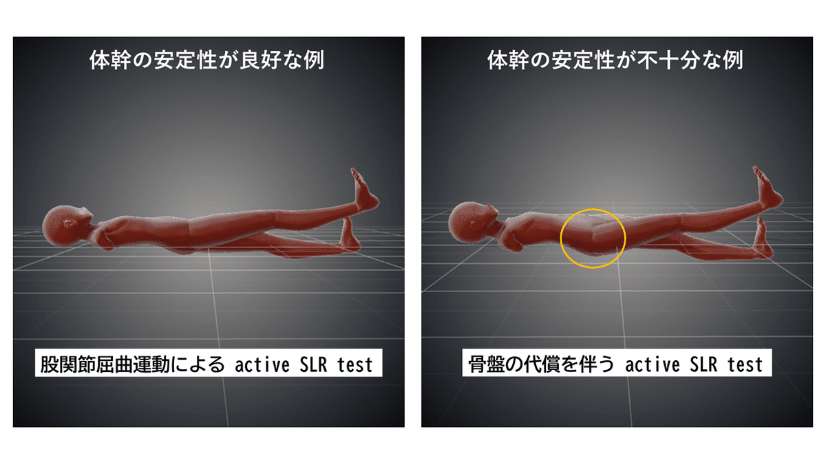 骨盤荷重伝達障害の評価とアプローチ〜ASLRとPHEの理解と臨床