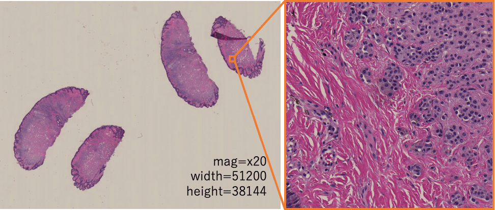 デジタル病理組織画像には例えばこんな特徴があります｜次世代