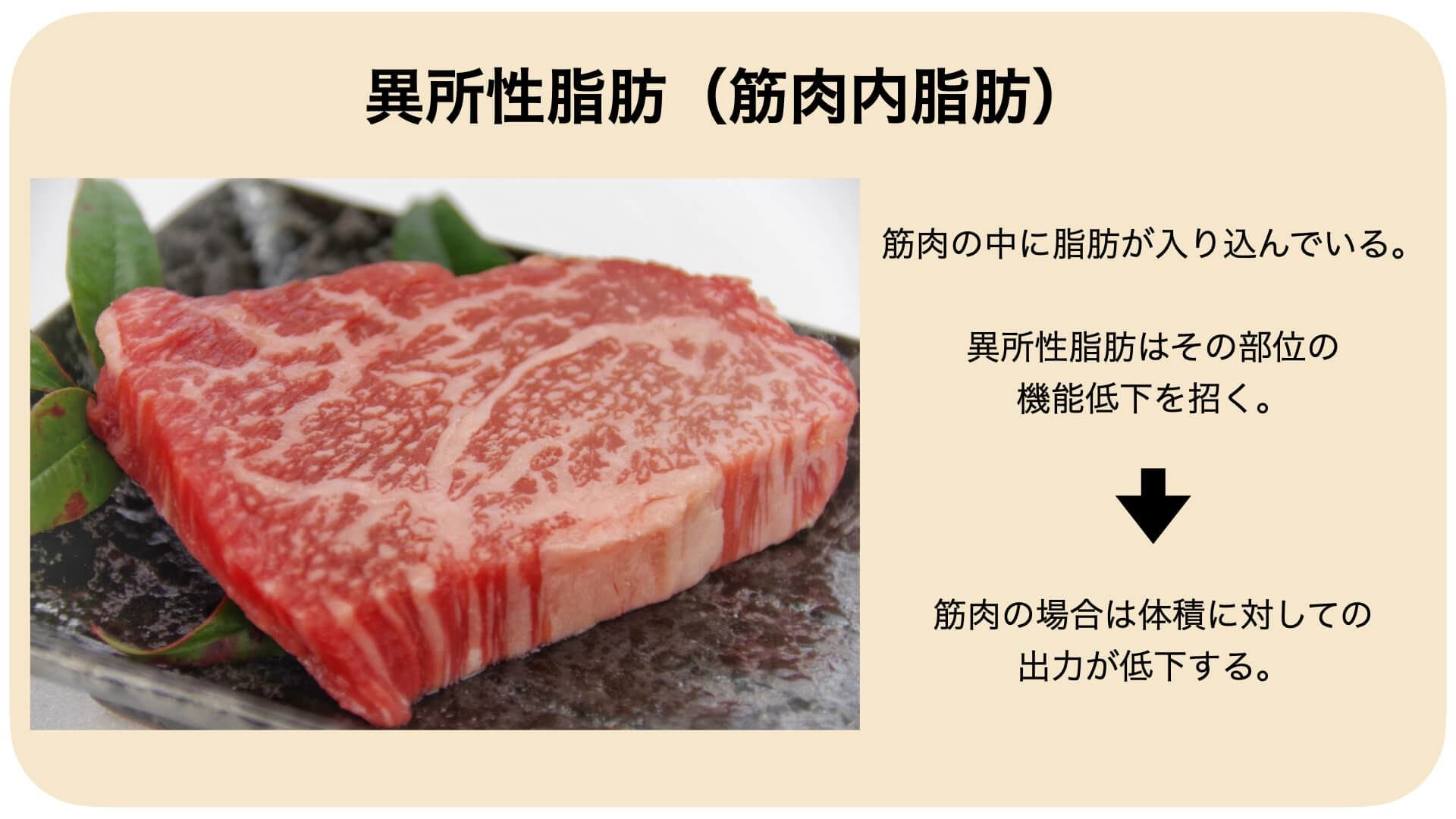 異所性拍動と妊娠