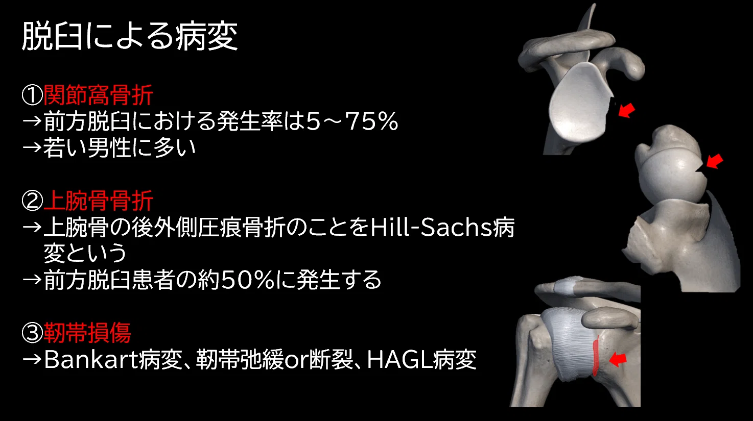肩関節脱臼と理学療法｜Asumi.Kumada