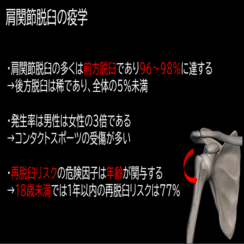 ドナルド脱臼 肩関節脱臼と理学療法｜Asumi.Kumada