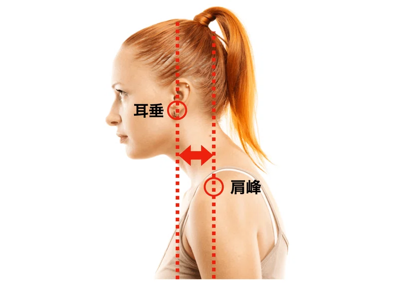 姿勢・アライメントの臨床評価|理学療法士による臨床のためのnote