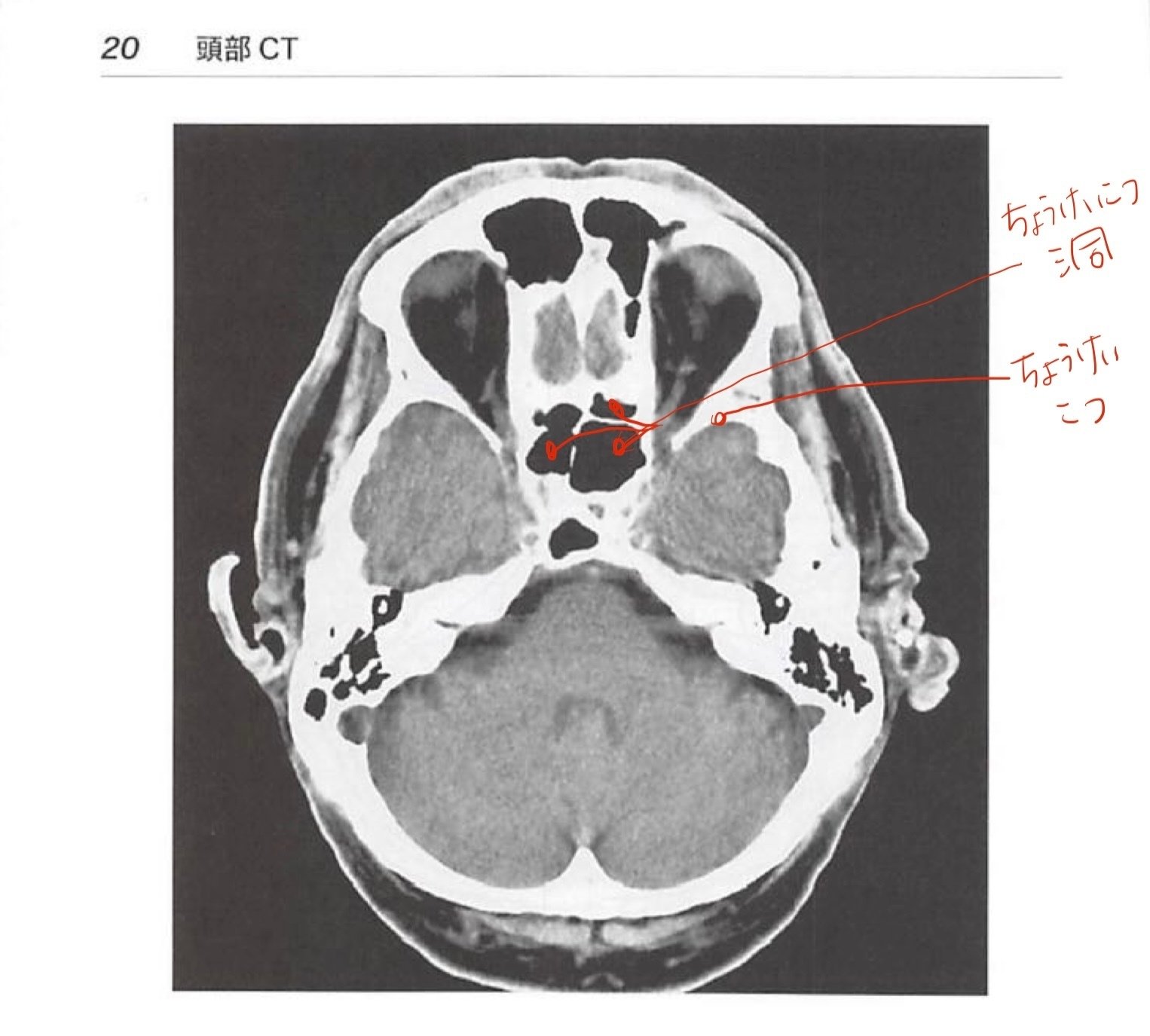 苦手な顔面骨CT |Zion 苦手な顔面骨CT |Zion